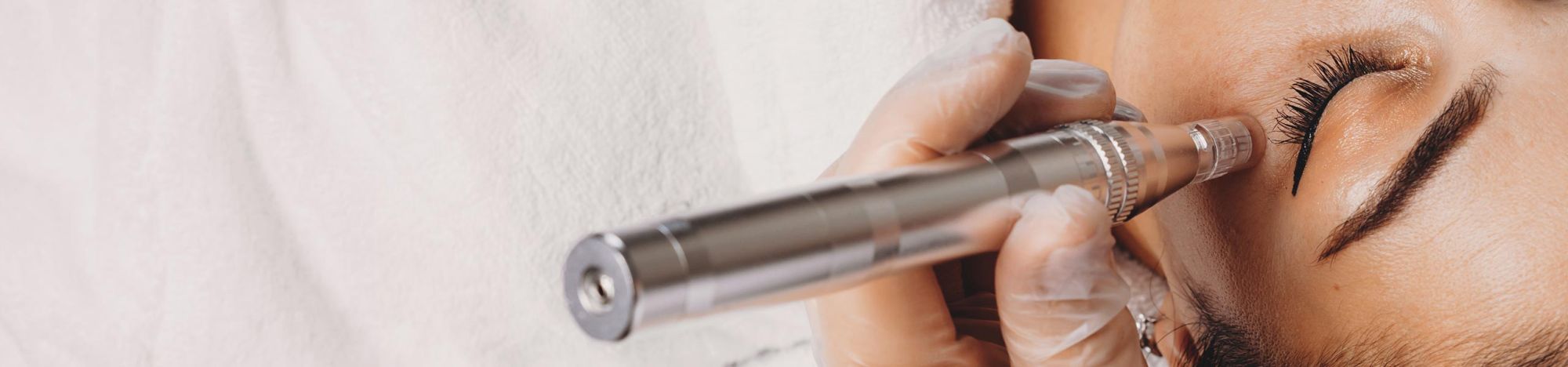 Microneedling